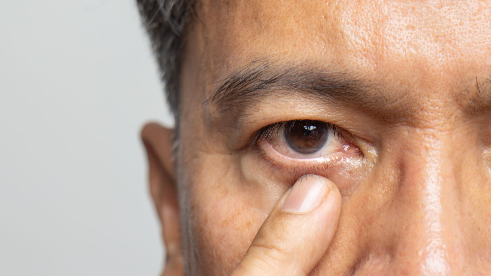 Senior man eyestrain after for long stretches at computer or digital screens